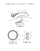 ROTICAM: An Orotracheal Guide with Camera diagram and image