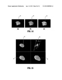 SYSTEM AND METHOD FOR PASSIVE MEDICAL DEVICE NAVIGATION UNDER REAL-TIME     MRI GUIDANCE diagram and image