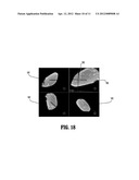 SYSTEM AND METHOD FOR PASSIVE MEDICAL DEVICE NAVIGATION UNDER REAL-TIME     MRI GUIDANCE diagram and image