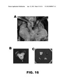 LIGANDS TO RADIATION-INDUCED MOLECULES diagram and image