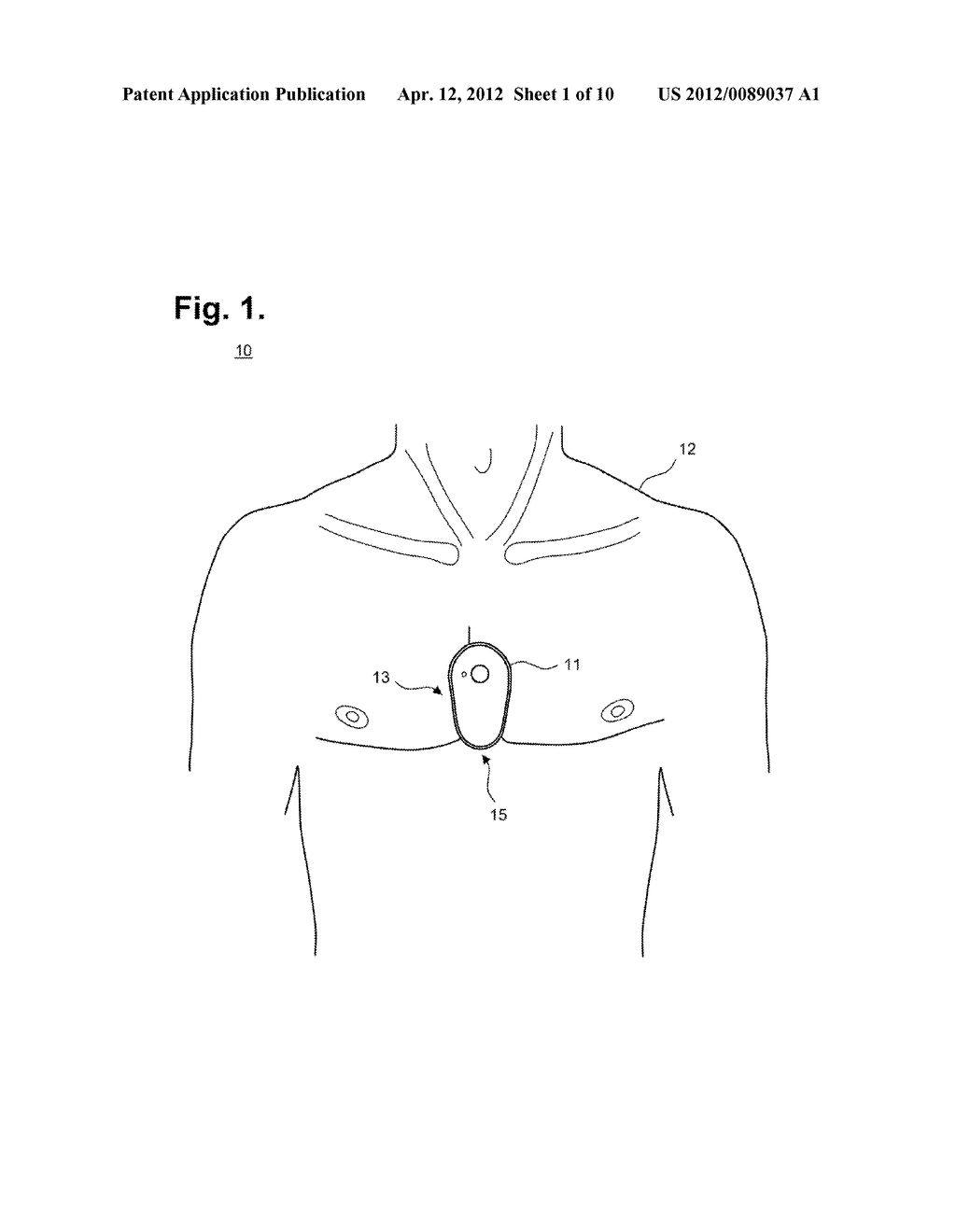 Ambulatory Electrocardiographic Monitor With Jumpered Sensing Electrode     And Method Of Use - diagram, schematic, and image 02