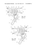 APPARATUS, SYSTEMS, AND METHODS FOR AUGMENTING THE FLOW OF FLUID WITHIN     BODY VESSELS diagram and image