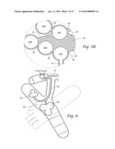 APPARATUS, SYSTEMS, AND METHODS FOR AUGMENTING THE FLOW OF FLUID WITHIN     BODY VESSELS diagram and image