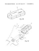 APPARATUS, SYSTEMS, AND METHODS FOR AUGMENTING THE FLOW OF FLUID WITHIN     BODY VESSELS diagram and image