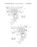 APPARATUS, SYSTEMS, AND METHODS FOR AUGMENTING THE FLOW OF FLUID WITHIN     BODY VESSELS diagram and image