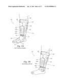 APPARATUS, SYSTEMS, AND METHODS FOR AUGMENTING THE FLOW OF FLUID WITHIN     BODY VESSELS diagram and image