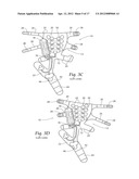 APPARATUS, SYSTEMS, AND METHODS FOR AUGMENTING THE FLOW OF FLUID WITHIN     BODY VESSELS diagram and image