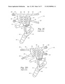 APPARATUS, SYSTEMS, AND METHODS FOR AUGMENTING THE FLOW OF FLUID WITHIN     BODY VESSELS diagram and image