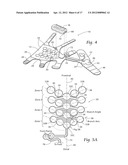 APPARATUS, SYSTEMS, AND METHODS FOR AUGMENTING THE FLOW OF FLUID WITHIN     BODY VESSELS diagram and image