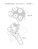 APPARATUS, SYSTEMS, AND METHODS FOR AUGMENTING THE FLOW OF FLUID WITHIN     BODY VESSELS diagram and image