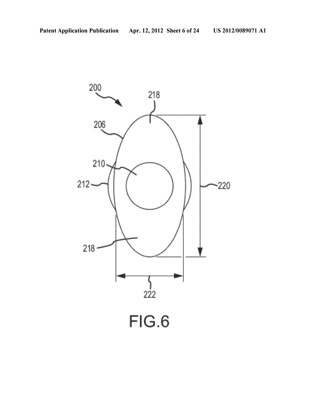 IMPLANT DEVICE, TOOL, AND METHODS RELATING TO TREATMENT OF PARANASAL     SINUSES - diagram, schematic, and image 07