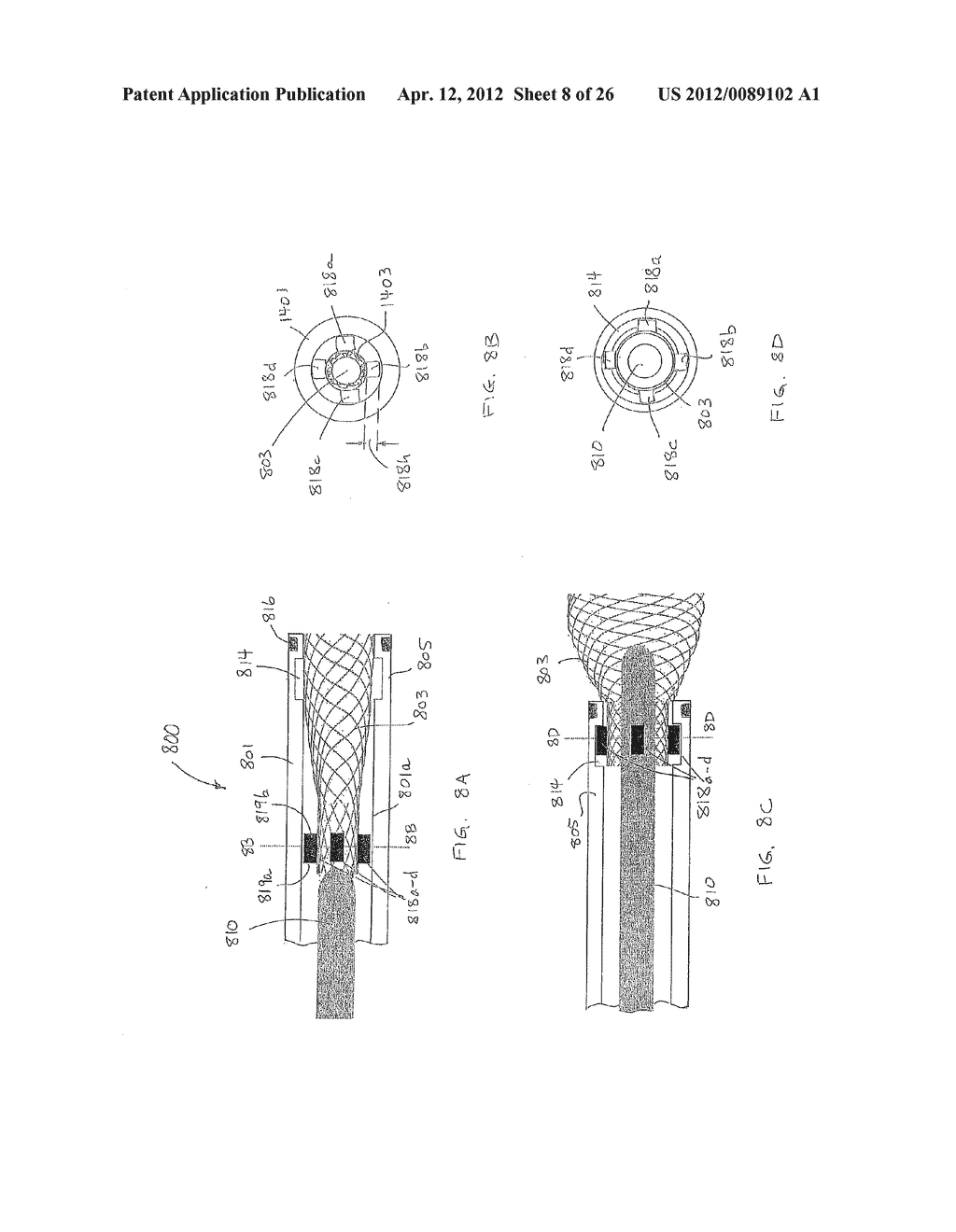 Microvalve Protection Device and Method of Use for Protection Against     Embolization Agent Reflux - diagram, schematic, and image 09