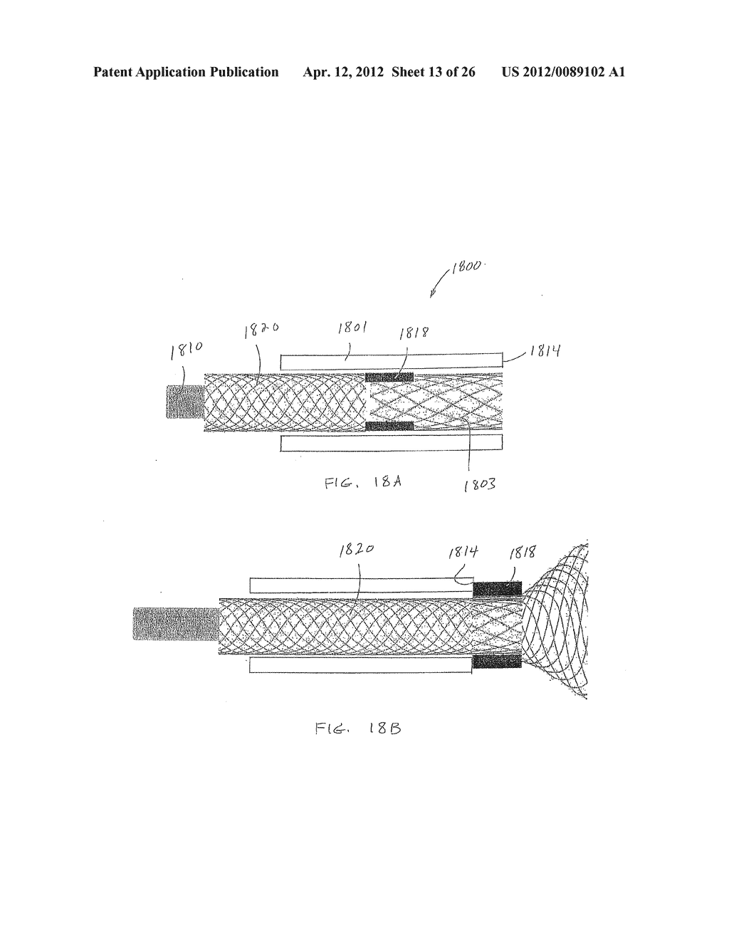 Microvalve Protection Device and Method of Use for Protection Against     Embolization Agent Reflux - diagram, schematic, and image 14