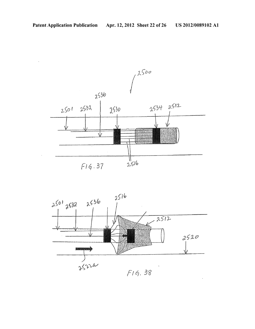 Microvalve Protection Device and Method of Use for Protection Against     Embolization Agent Reflux - diagram, schematic, and image 23