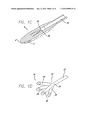 Reduction of Recirculation in Catheters diagram and image