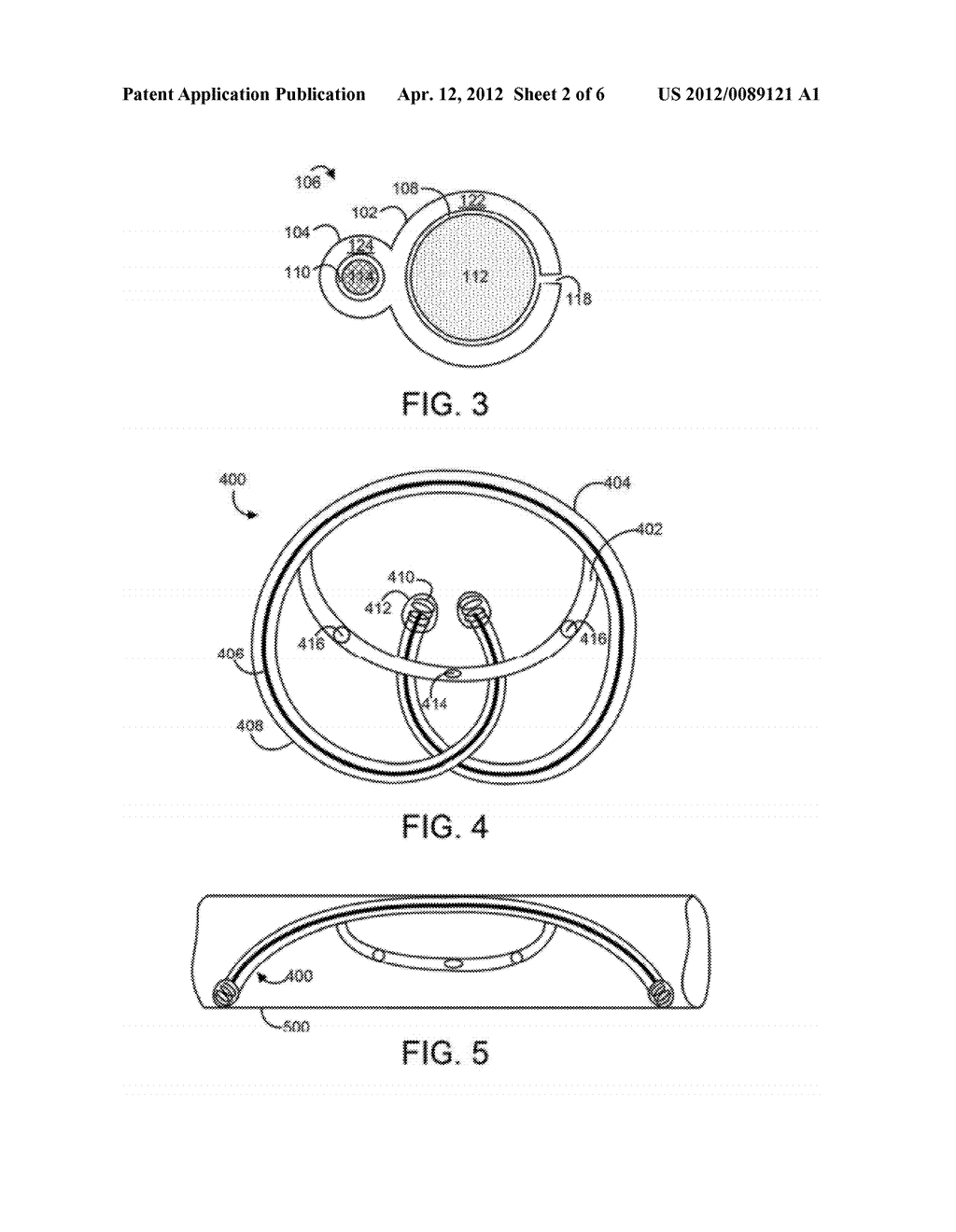 Implantable Drug Delivery Device with Bladder Retention Feature - diagram, schematic, and image 03