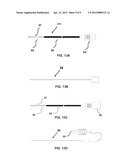 ADVANCED MULTI-PURPOSE CATHETER PROBES FOR DIAGNOSTIC AND THERAPEUTIC     PROCEDURES diagram and image