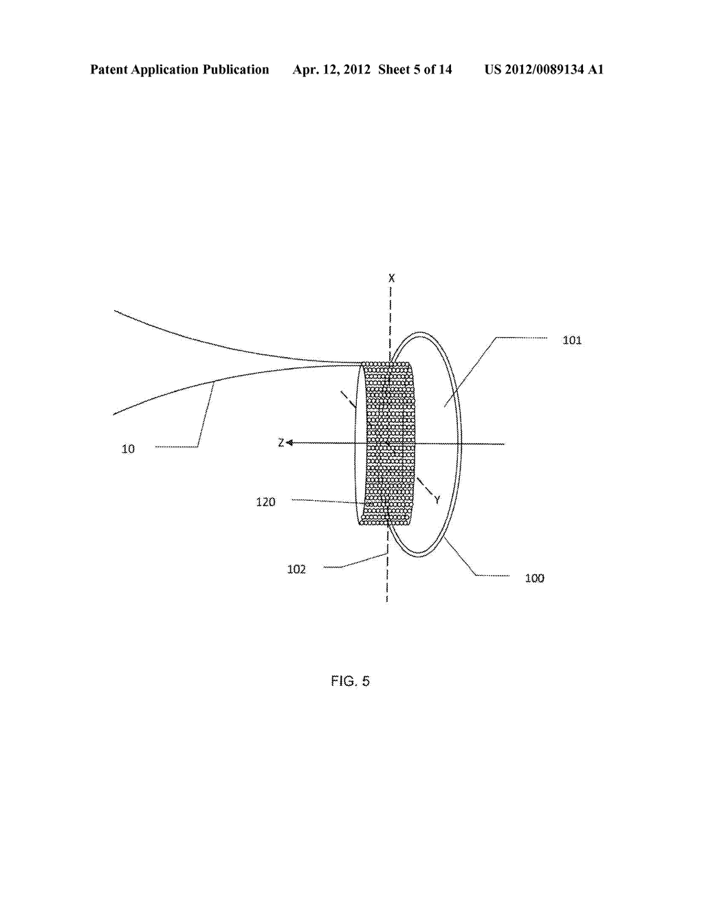 Contactless Photodisruptive Laser assisted Cataract Surgery - diagram, schematic, and image 06