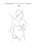 STOMACH INSTRUMENT AND METHOD diagram and image