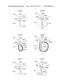 STOMACH INSTRUMENT AND METHOD diagram and image