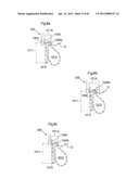 STOMACH INSTRUMENT AND METHOD diagram and image