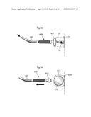 STOMACH INSTRUMENT AND METHOD diagram and image