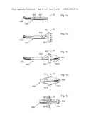 STOMACH INSTRUMENT AND METHOD diagram and image