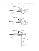 STOMACH INSTRUMENT AND METHOD diagram and image