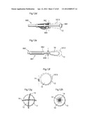 STOMACH INSTRUMENT AND METHOD diagram and image