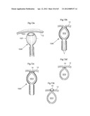 STOMACH INSTRUMENT AND METHOD diagram and image