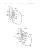 STOMACH INSTRUMENT AND METHOD diagram and image