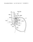 STOMACH INSTRUMENT AND METHOD diagram and image