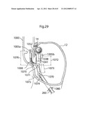 STOMACH INSTRUMENT AND METHOD diagram and image