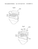 STOMACH INSTRUMENT AND METHOD diagram and image