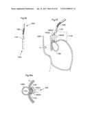 STOMACH INSTRUMENT AND METHOD diagram and image