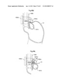 STOMACH INSTRUMENT AND METHOD diagram and image