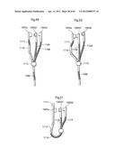 STOMACH INSTRUMENT AND METHOD diagram and image