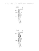 STOMACH INSTRUMENT AND METHOD diagram and image