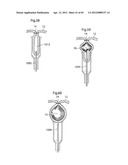 STOMACH INSTRUMENT AND METHOD diagram and image