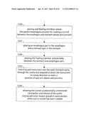 STOMACH INSTRUMENT AND METHOD diagram and image