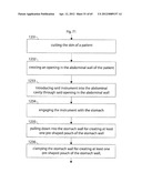 STOMACH INSTRUMENT AND METHOD diagram and image