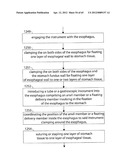 STOMACH INSTRUMENT AND METHOD diagram and image