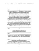 STOMACH INSTRUMENT AND METHOD diagram and image