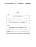 STOMACH INSTRUMENT AND METHOD diagram and image