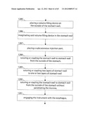 STOMACH INSTRUMENT AND METHOD diagram and image