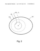 BARIATRIC DEVICE AND METHOD diagram and image