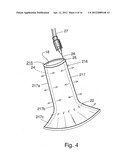 BARIATRIC DEVICE AND METHOD diagram and image