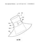 BARIATRIC DEVICE AND METHOD diagram and image