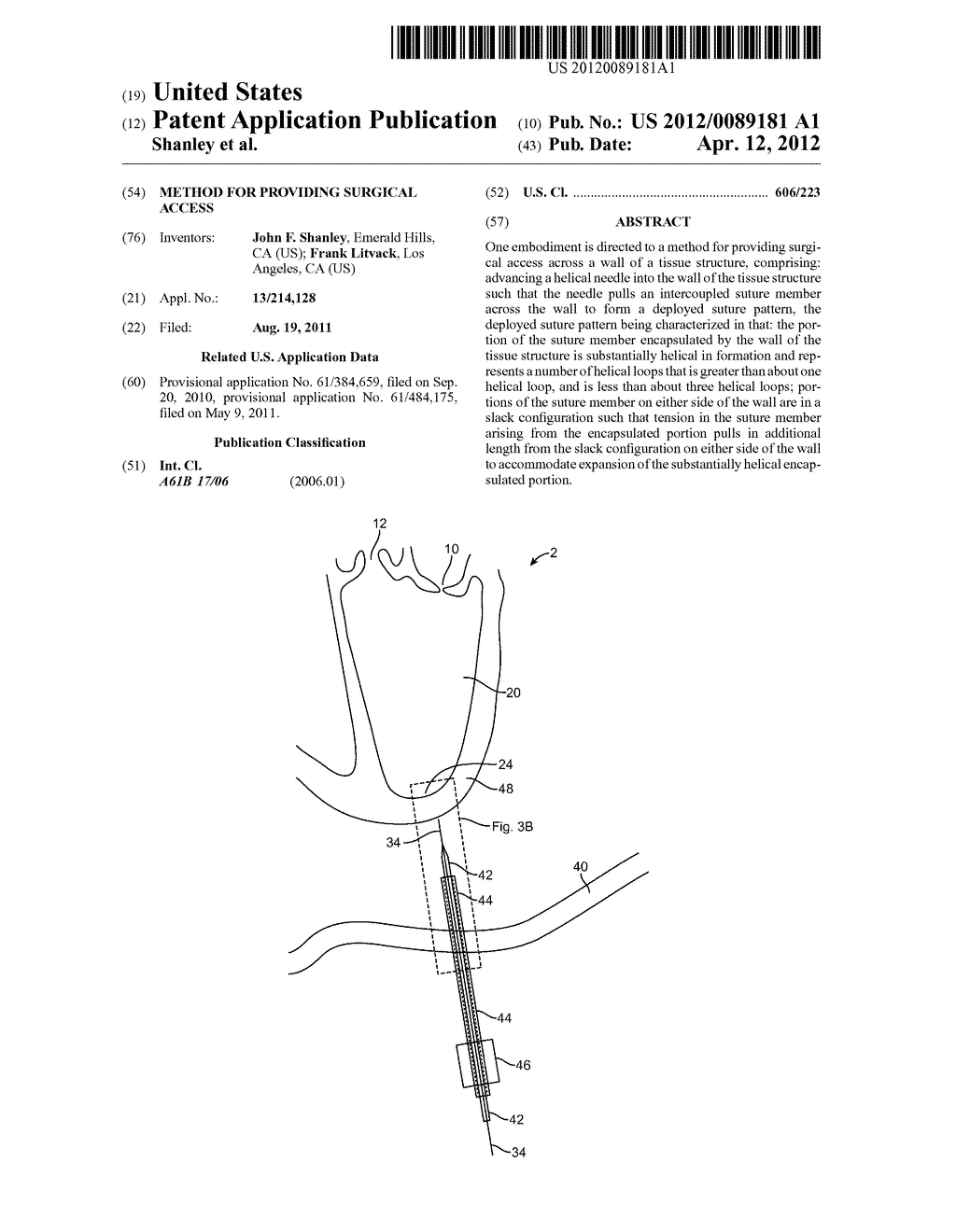 METHOD FOR PROVIDING SURGICAL ACCESS - diagram, schematic, and image 01