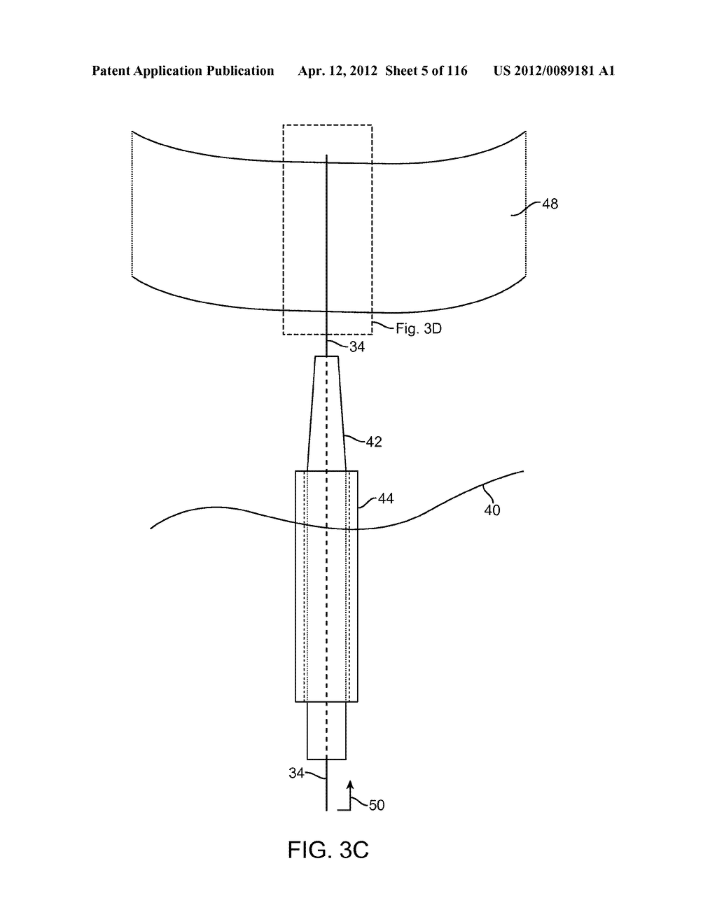 METHOD FOR PROVIDING SURGICAL ACCESS - diagram, schematic, and image 06